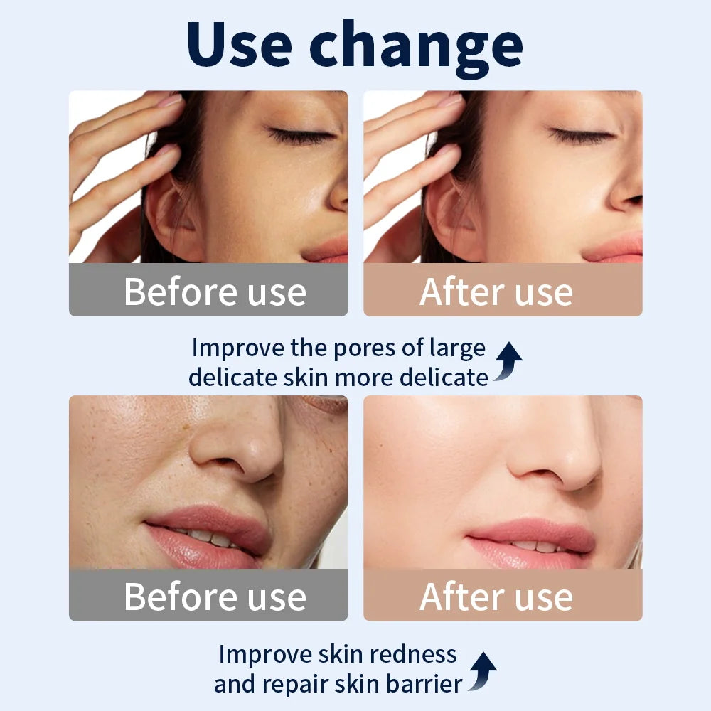 Mascarilla LED facial - Rejuvenecedora